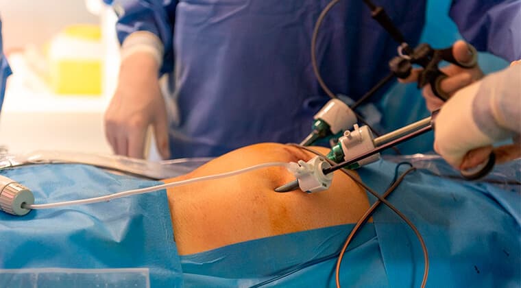 Colecistectomía laparoscópica